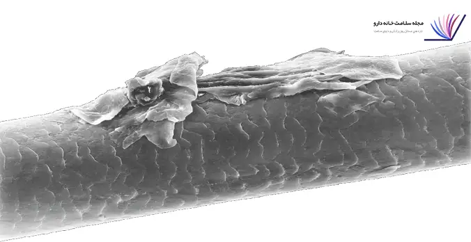 آسیب ساقه مو