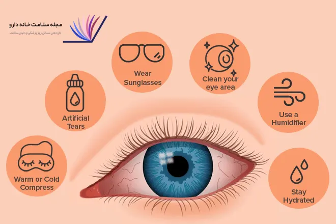 Treatment of dry eyes