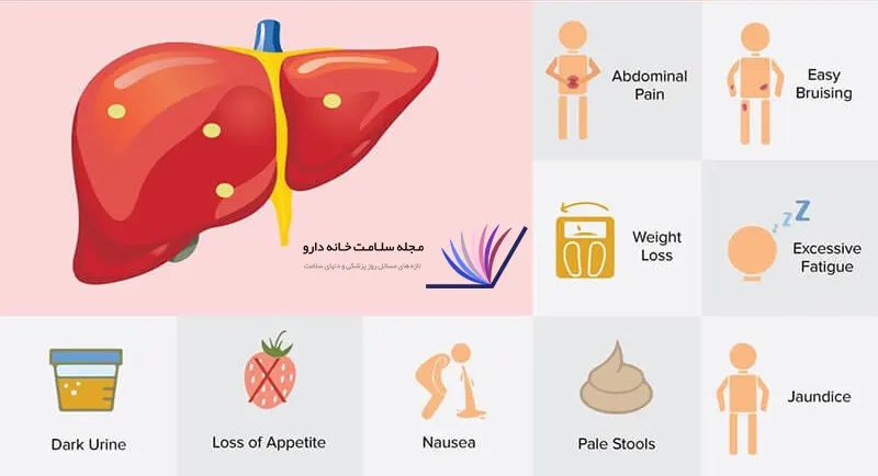 علائم کبد چرب